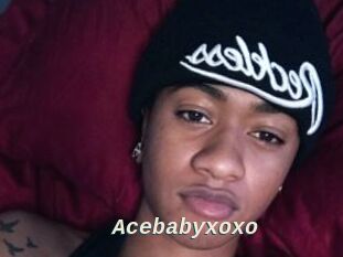 Acebabyxoxo