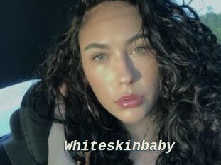 Whiteskinbaby